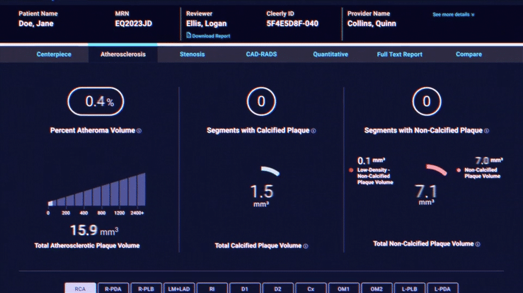 Cleerly® AI and Preventive Cardiology at HormoneSynergy® Clinic
