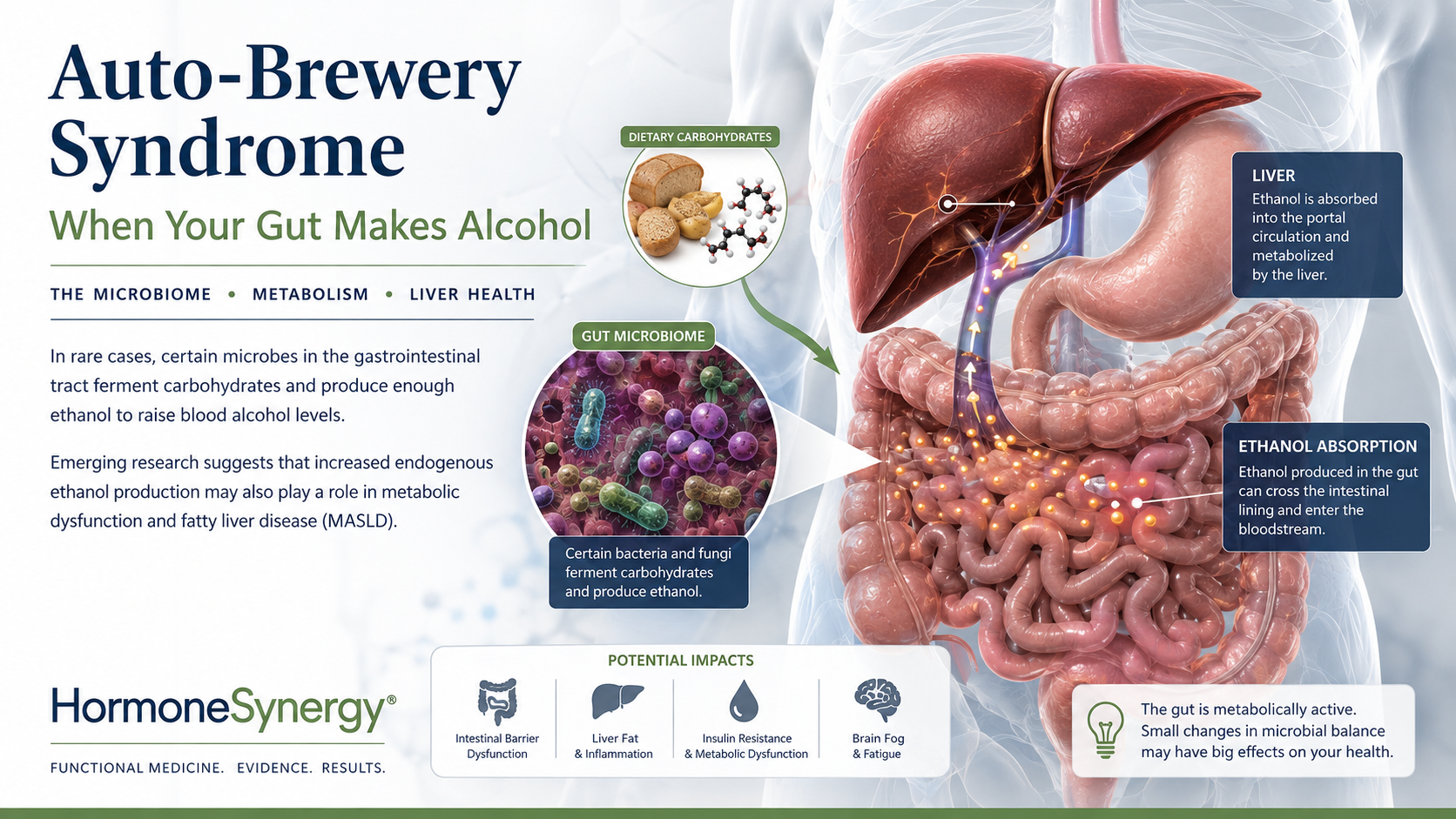 Medical editorial illustration showing gut microbes producing endogenous ethanol from carbohydrates and the relationship between intestinal metabolism and the liver.