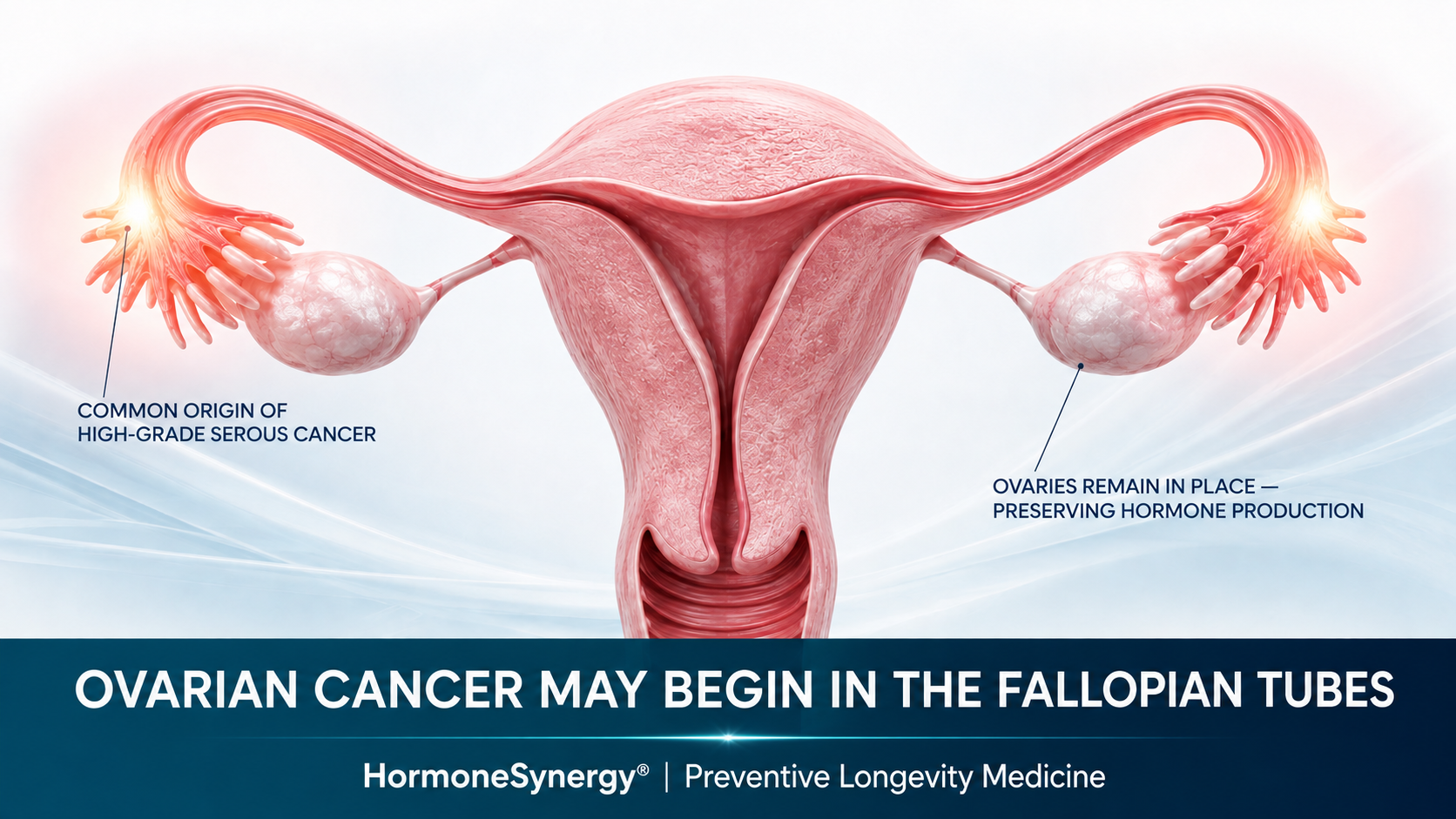 Could Removing the Fallopian Tubes Prevent Ovarian Cancer?